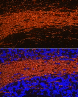 ABclonal Technology&nbsp;CNPase Rabbit pAb