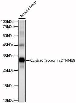 ABclonal Technology&nbsp;Cardiac Troponin I (TNNI3) Rabbit pAb