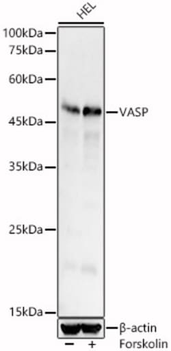ABclonal Technology&nbsp;VASP Rabbit pAb