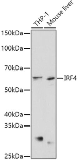 ABclonal Technology&nbsp;IRF4 Rabbit pAb
