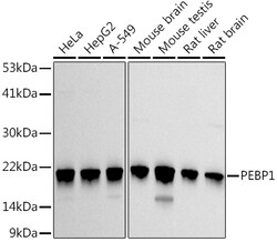 ABclonal Technology&nbsp;PEBP1 Rabbit pAb