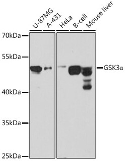ABclonal Technology&nbsp;GSK3α Rabbit pAb