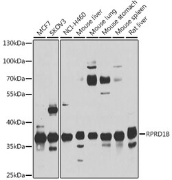 ABclonal Technology&nbsp;RPRD1B Rabbit pAb