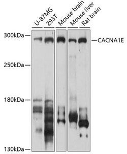 ABclonal Technology&nbsp;CACNA1E Rabbit pAb