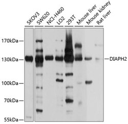 ABclonal Technology&nbsp;DIAPH2 Rabbit pAb