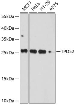 ABclonal Technology&nbsp;TPD52 Rabbit pAb