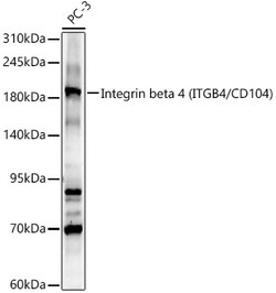 ABclonal Technology&nbsp;Integrin beta 4 (ITGB4/CD104) Rabbit pAb