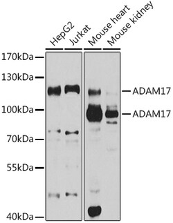 ABclonal Technology&nbsp;ADAM17 Rabbit pAb