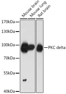 ABclonal Technology&nbsp;PKC delta Rabbit pAb