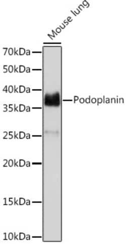 ABclonal Technology&nbsp;Podoplanin Rabbit mAb