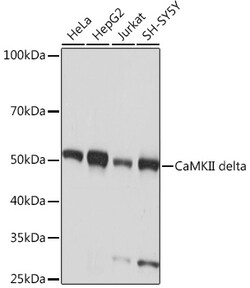 ABclonal Technology&nbsp;CaMKII delta Rabbit mAb