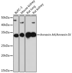ABclonal Technology&nbsp;Annexin A4/Annexin IV Rabbit mAb