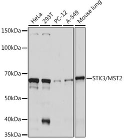 ABclonal Technology&nbsp;STK3/MST2 Rabbit mAb