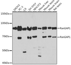 ABclonal Technology&nbsp;RanGAP1 Rabbit mAb