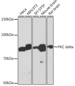 ABclonal Technology&nbsp;PKC delta Rabbit mAb