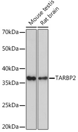 ABclonal Technology&nbsp;TARBP2 Rabbit mAb