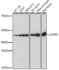 ABclonal Technology&nbsp;SSTR5 Rabbit mAb