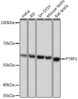ABclonal Technology&nbsp;PTBP2 Rabbit mAb