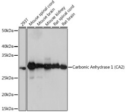 ABclonal Technology&nbsp;Carbonic Anhydrase 2 (CA2) Rabbit mAb