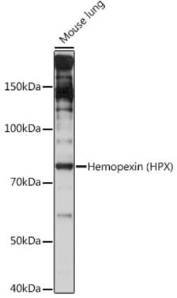 ABclonal Technology&nbsp;Hemopexin (HPX) Rabbit mAb