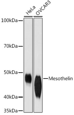 ABclonal Technology&nbsp;Mesothelin Rabbit mAb