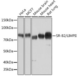 ABclonal Technology&nbsp;SR-B2/LIMPII Rabbit mAb