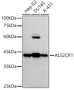 ABclonal Technology&nbsp;ALS2CR1 Rabbit mAb