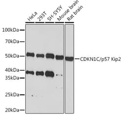 ABclonal Technology&nbsp;CDKN1C/p57 Kip2 Rabbit mAb
