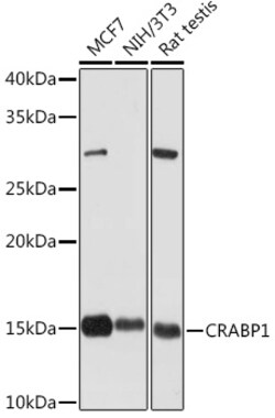 ABclonal Technology&nbsp;CRABP1 Rabbit mAb