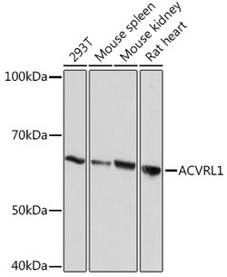 ABclonal Technology&nbsp;ACVRL1 Rabbit mAb
