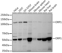 ABclonal Technology&nbsp;ORP1 Rabbit mAb