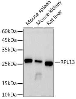 ABclonal Technology&nbsp;RPL13 Rabbit mAb