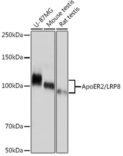 ABclonal Technology&nbsp;ApoER2/LRP8 Rabbit mAb
