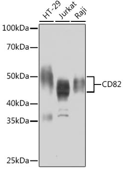 ABclonal Technology&nbsp;CD82 Rabbit mAb