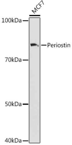 ABclonal Technology&nbsp;Periostin Rabbit mAb