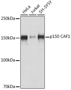 ABclonal Technology&nbsp;p150 CAF1 Rabbit mAb