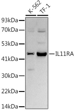 ABclonal Technology&nbsp;IL11RA Rabbit mAb
