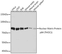 ABclonal Technology&nbsp;Nuclear Matrix Protein p84 (THOC1) Rabbit mAb