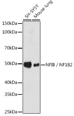 ABclonal Technology&nbsp;NFIB / NF1B2 Rabbit mAb