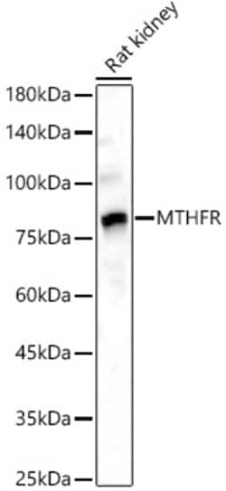 ABclonal Technology&nbsp;MTHFR Rabbit pAb