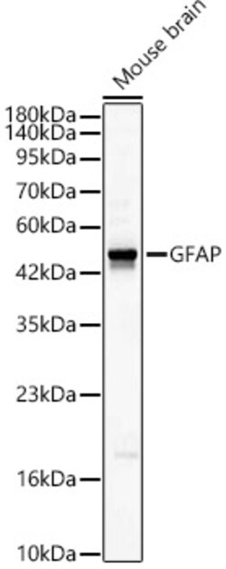 ABclonal Technology&nbsp;GFAP Rabbit pAb