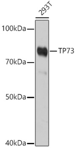 ABclonal Technology&nbsp;TP73 Rabbit pAb