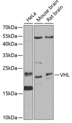 ABclonal Technology&nbsp;VHL Rabbit pAb