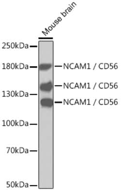 ABclonal Technology&nbsp;NCAM1 / CD56 Rabbit pAb