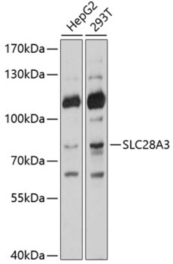 ABclonal Technology&nbsp;SLC28A3 Rabbit pAb