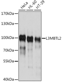 ABclonal Technology&nbsp;L3MBTL2 Rabbit pAb