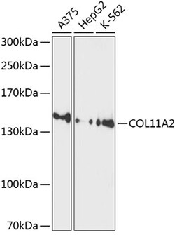 ABclonal Technology&nbsp;COL11A2 Rabbit pAb