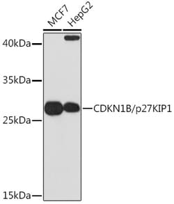 ABclonal Technology CDKN1B/p27KIP1 Rabbit pAb