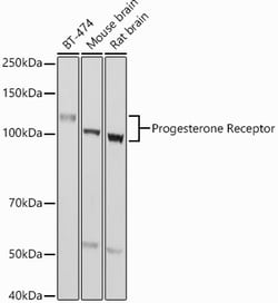 ABclonal Technology&nbsp;Progesterone Receptor Rabbit pAb