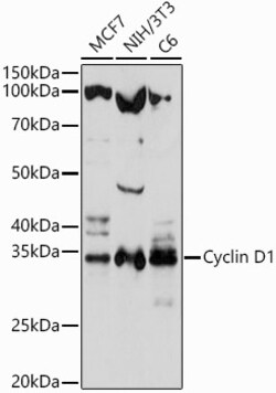 ABclonal Technology&nbsp;Cyclin D1 Rabbit pAb